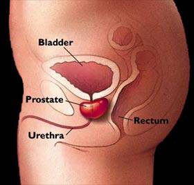 La prostata y sus cuidados